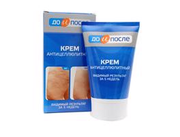 Krém a narancsbőr ellen és a sejtek vérkeringésének kezelésére - ELŐTTE ÉS UTÁNA-100ml